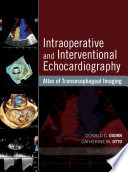 Intraoperative and interventional echocardiography : atlas of transesophageal imaging /