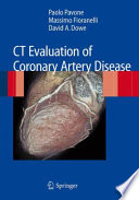 CT evaluation of coronary artery disease /