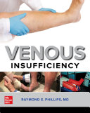 Venous insufficiency : recognizing and treating the disease of gravity /