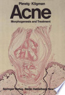Acne : Morphogenesis and Treatment /