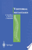 Vertebral metastases /