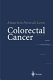 Colorectal cancer /