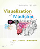 Visualization in medicine : theory, algorithms, and applications /