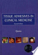 Tissue adhesives in clinical medicine /