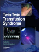 Twin-twin transfusion syndrome /