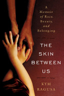 The skin between us : a memoir of race, beauty, and belonging /