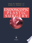 Endoscopic Plastic Surgery /