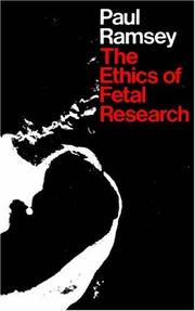 The ethics of fetal research /