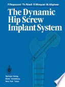 The Dynamic Hip Screw Implant System /