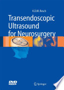 Transendoscopic ultrasound for neurosurgery /