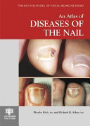 An atlas of diseases of the nail /