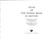 Atlas of the human brain in section /