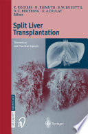Split liver transplantation : Theoretical and practical aspects /