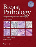 Breast pathology : diagnosis by needle core biopsy /