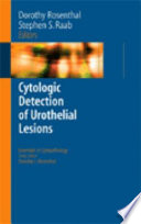 Cytologic detection of urothelial lesions /