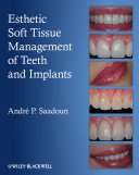 Esthetic soft tissue management of teeth and implants /