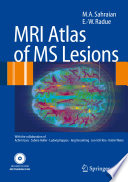 MRI atlas of lesions in multiple sclerosis /