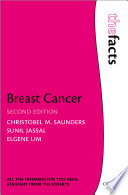 Breast cancer /