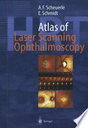 Atlas of laser scanning ophthalmoscopy /
