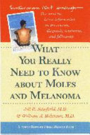 What you really need to know about moles and melanoma /