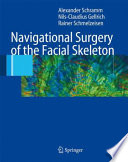 Navigational surgery of the facial skeleton /