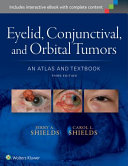 Eyelid, conjunctival, and orbital tumors : an atlas and textbook /