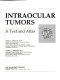 Intraocular tumors : a text and atlas /