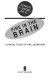 Fire in the brain : clinical tales of hallucination /