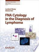 FNA cytology in the diagnosis of lymphoma /