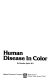 Human disease in color /