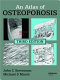 An atlas of osteoporosis /