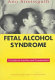 Fetal alcohol syndrome : a guide for families and communities /