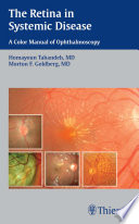 The retina in systemic disease : a color manual of ophthalmoscopy /
