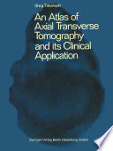 An atlas of axial transverse tomography and its clinical application : With 576 figures.