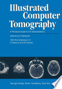 Illustrated Computer Tomography : A Practical Guide to CT Interpretations /