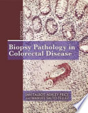 Biopsy pathology in colorectal disease /