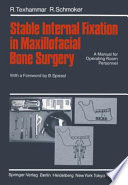 Stable Internal Fixation in Maxillofacial Bone Surgery : A Manual for Operating Room Personnel /