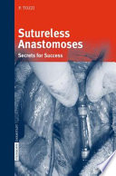 Sutureless anastomoses : secrets for success /