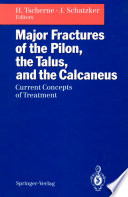 Major Fractures of the Pilon, the Talus, and the Calcaneus : Current Concepts of Treatment /