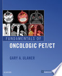 Fundamentals of oncologic PET/CT /