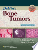 Dahlin's bone tumors : general aspects and data on 10,165 cases /