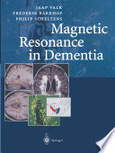 Magnetic resonance in dementia /