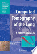 Computed tomography of the lung : a pattern approach /
