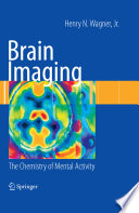 Brain imaging : the chemistry of mental activity /