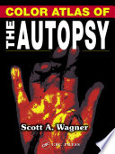 Color atlas of the autopsy /