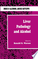 Liver Pathology and Alcohol /