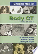 Fundamentals of body CT /