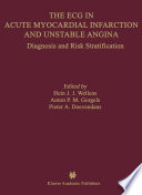 The ECG in acute myocardial infarction and unstable angina : diagnosis and risk stratification /