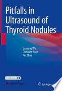 Pitfalls in Ultrasound of Thyroid Nodules /