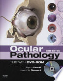 Ocular pathology.